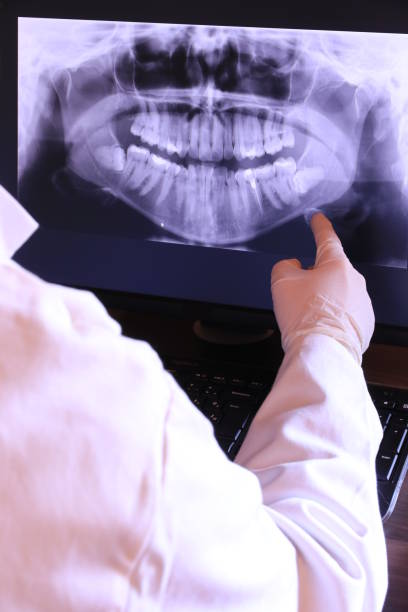 Best Mobile Emergency Dentist in Royal City, WA