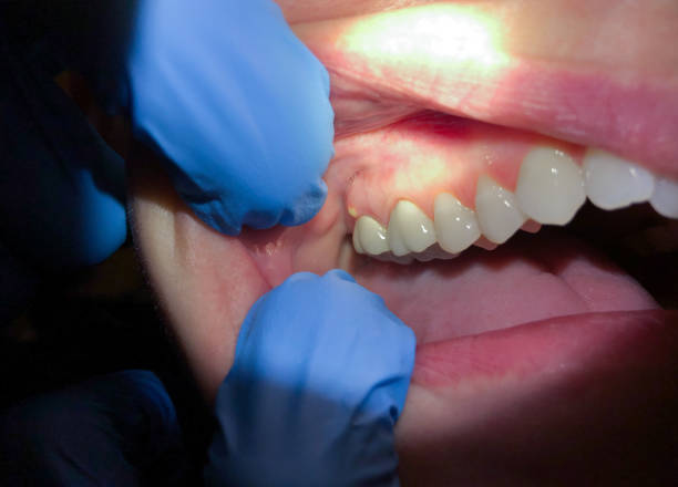 Best Pediatric Emergency Dentist in Royal City, WA
